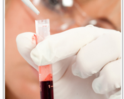Виды анализов крови